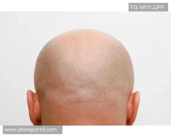 美记建议布朗剃光头更省心发际线粉不如简单直接 美记建议布朗剃光头更省心发际线粉不如简单直接